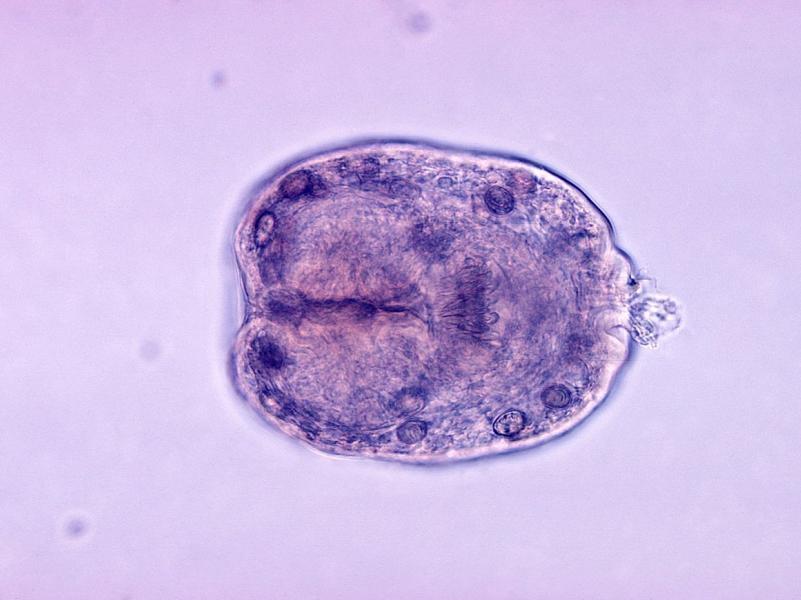 Ð“Ð¸ÑÑ‚Ð¾Ð»Ð¾Ð³Ð¸Ñ‡ÐµÑÐºÐ¸Ð¹ Ð¿Ñ€ÐµÐ¿Ð°Ñ€Ð°Ñ‚ Echinococcus granulosus eiqetiddzitkglv